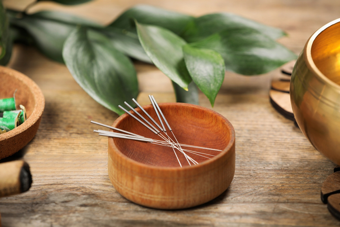 acupuncture herbal medicine